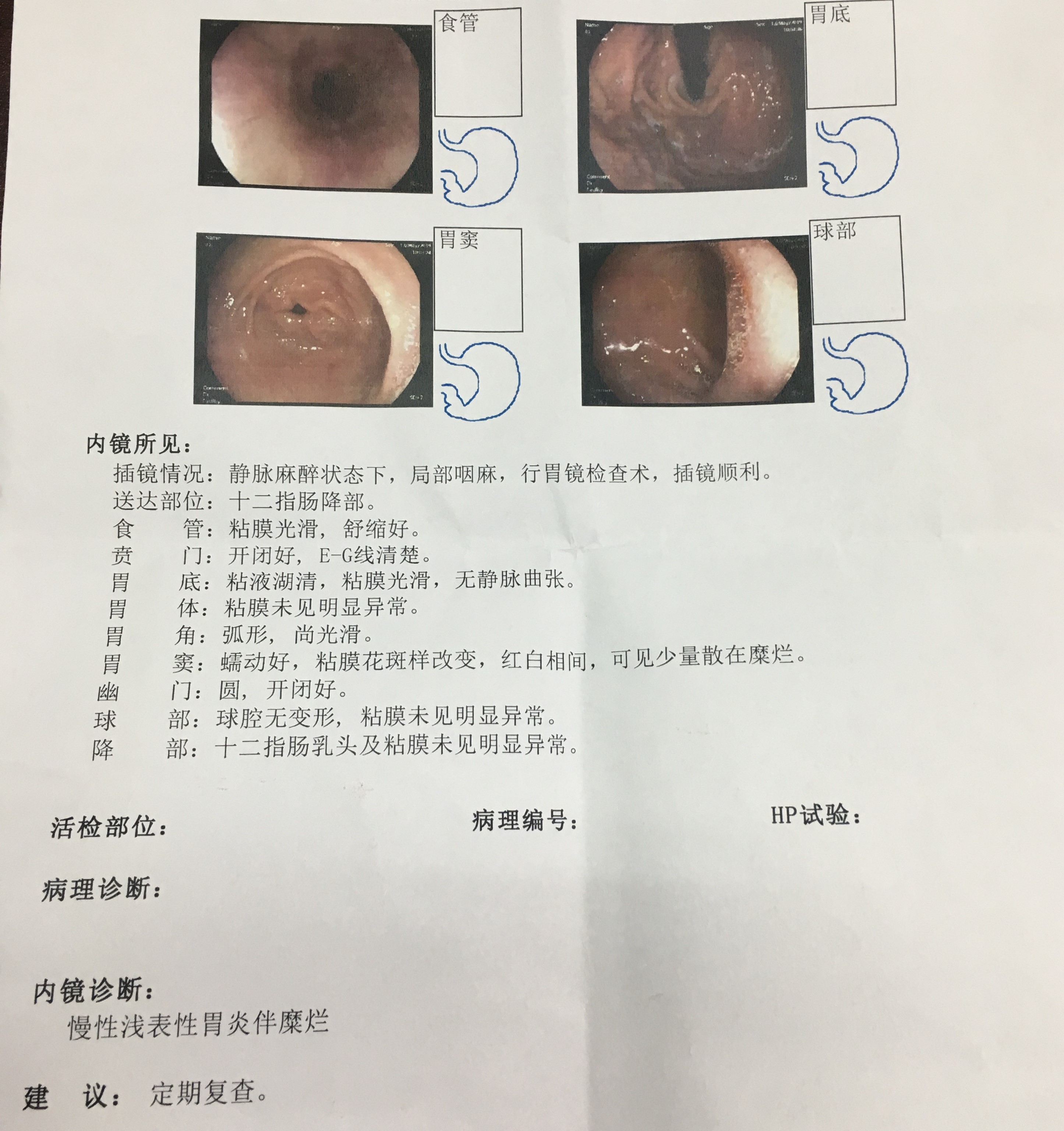 “天天博士”亲历胃镜检查，慢性胃炎伴糜烂该怎么办？