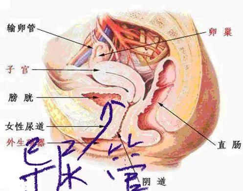 当女人膀胱、宫颈、直肠被癌症强行“打通”以后会是什么后果?