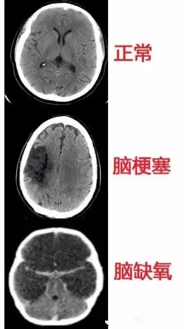 面神经分布图片大全,怎么记住面神经分布