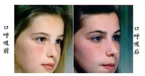 适合尖下巴的发型图片欣赏,下巴短适合什么样的发型图片欣赏