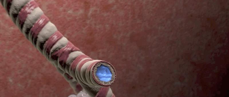 哮喘的发病原理,哮喘科普文章作品简介