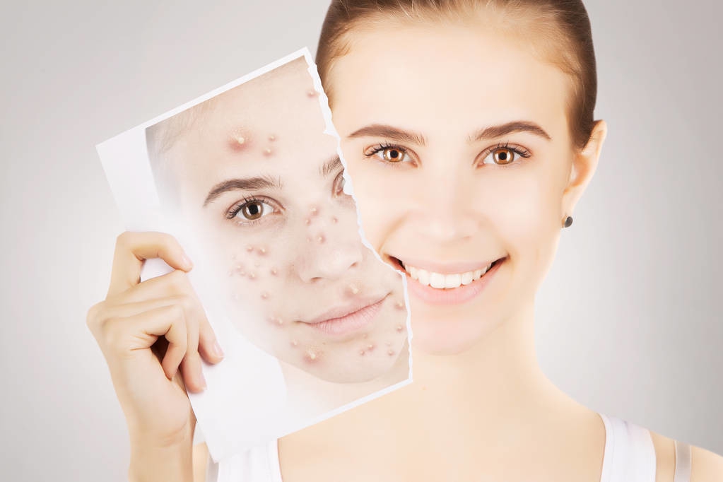 疮要怎么治疗,疮疗的后遗症怎么治疗