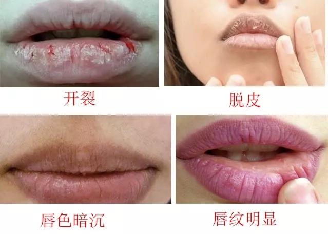 再昂贵的口红也只是点缀,遮盖深唇纹最好的口红