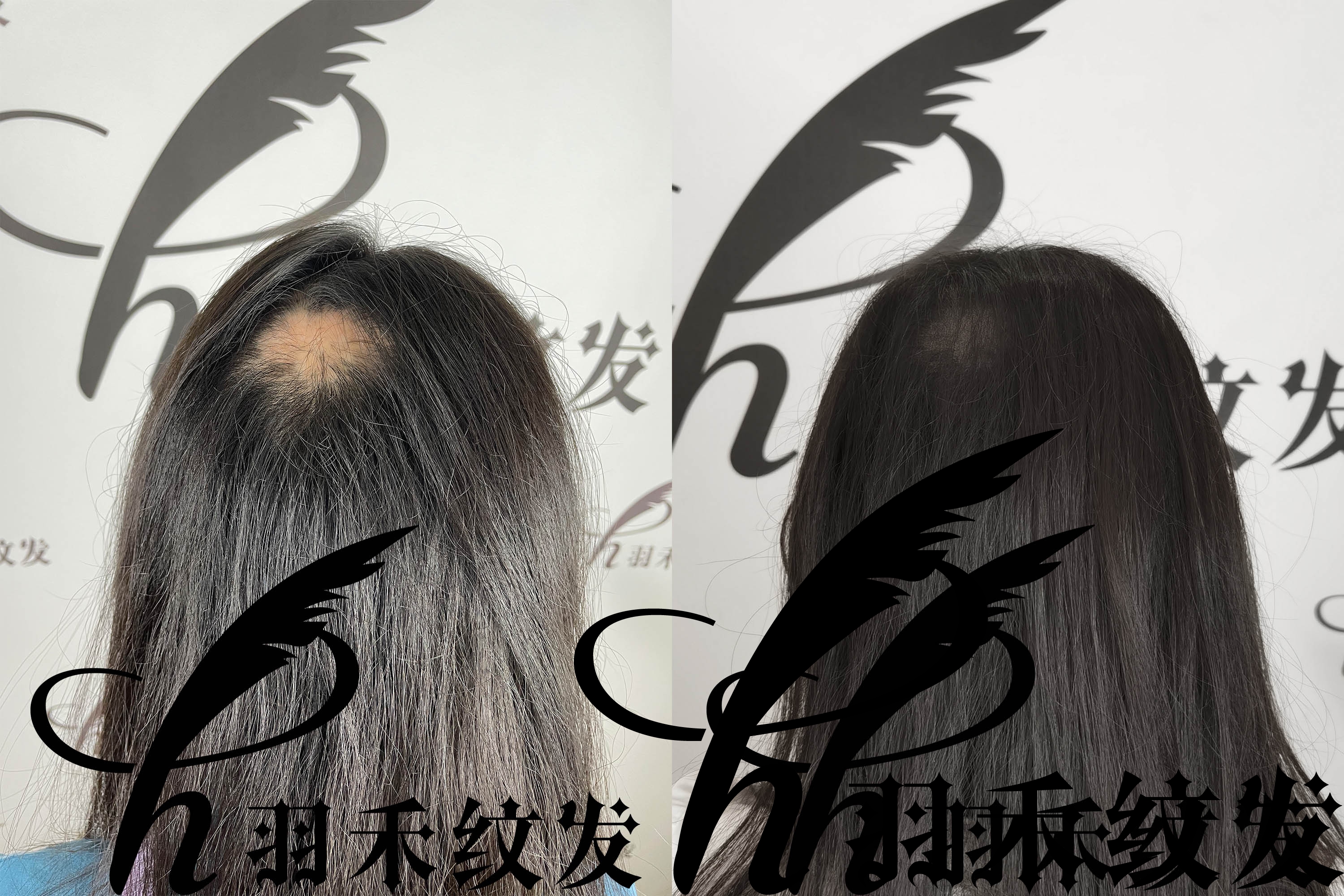 濂冲＋澶撮儴浼ゅ彛濡備綍鍖呮墡,濂冲＋澶撮儴浼ゅ彛缁峰甫鍖呮墡瑙嗛