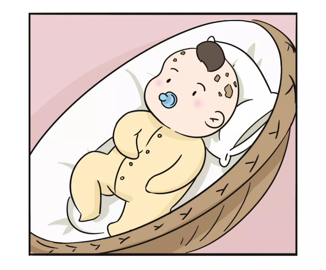 4个月宝宝头皮乳痂反复起怎么办,婴儿头皮乳痂能去除吗