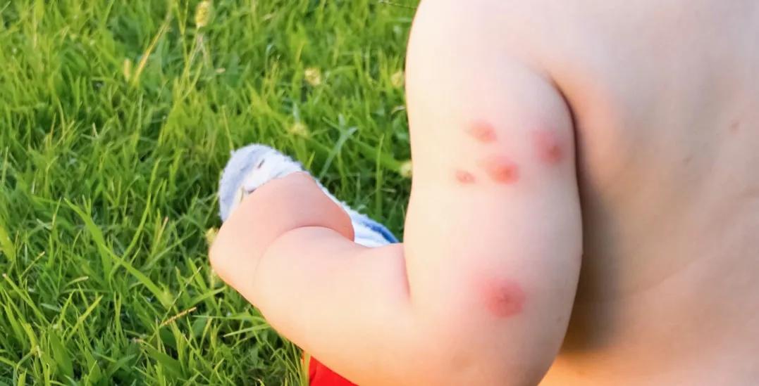 儿童皮肤问题擦什么面霜,小孩皮肤擦什么药膏好