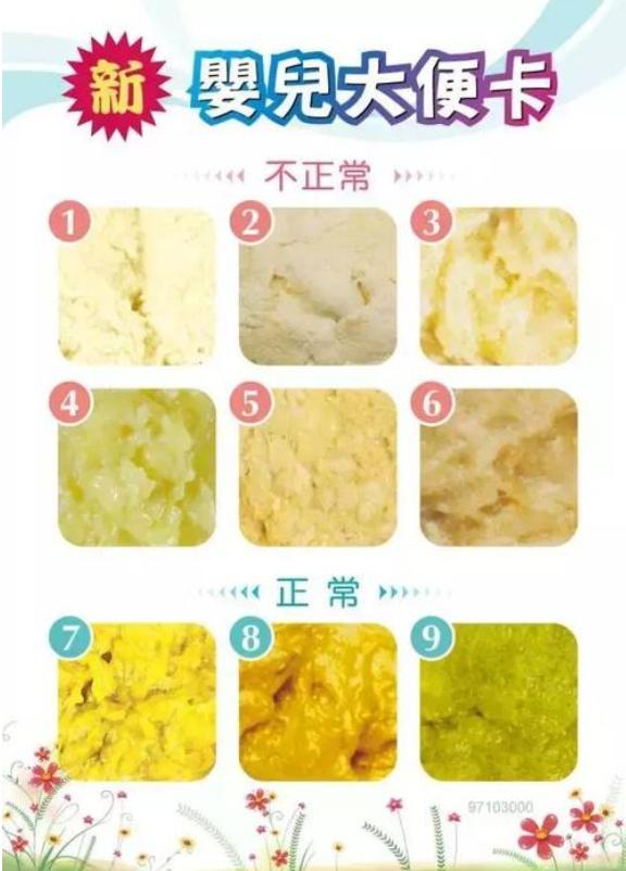 新生儿一天几次排便是正常的,新生儿每日排便几次正常