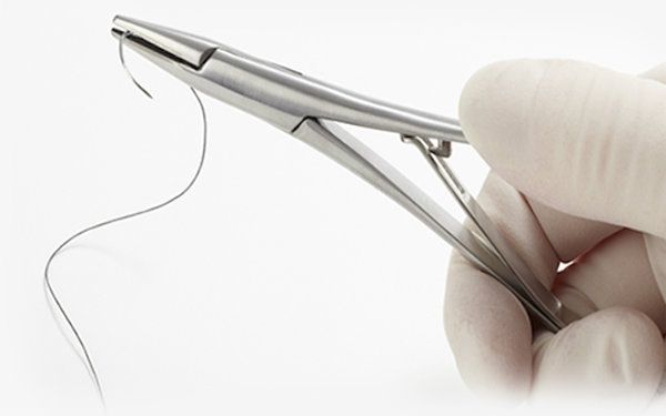 术后多久拆线不拆会有影响吗,手术术后大约几天拆线拆线会痛吗