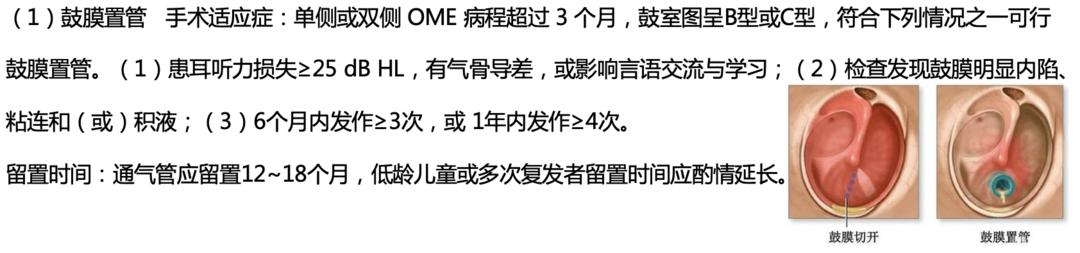 WASS峰会｜针对病因有效治疗，可改善部分儿童的听力损失