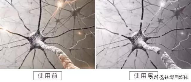 耳朵里面有蚊子嗡嗡响怎么解决,晚上睡觉蚊子嗡嗡响一招解决