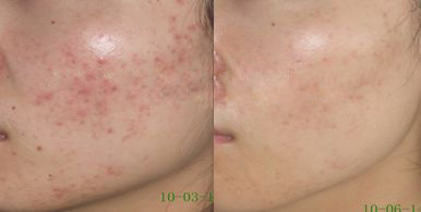 <html>
<head><title>502BadGateway</title></head>
<body>
<center><h1>502BadGateway</h1></center>
<hr><center>nginx</center>
</body>
</html>
<!--apaddingtodisableMSIEandChromefriendlyerrorpage-->
<!--apaddingtodisableMSIEandChromefriendlyerrorpage-->
<!--apaddingtodisableMSIEandChromefriendlyerrorpage-->
<!--apaddingtodisableMSIEandChromefriendlyerrorpage-->
<!--apaddingtodisableMSIEandChromefriendlyerrorpage-->
<!--apaddingtodisableMSIEandChromefriendlyerrorpage-->
