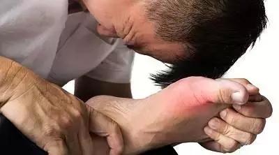 推荐痛风患者吃的食疗方,医生说这十种药膳可以治痛风