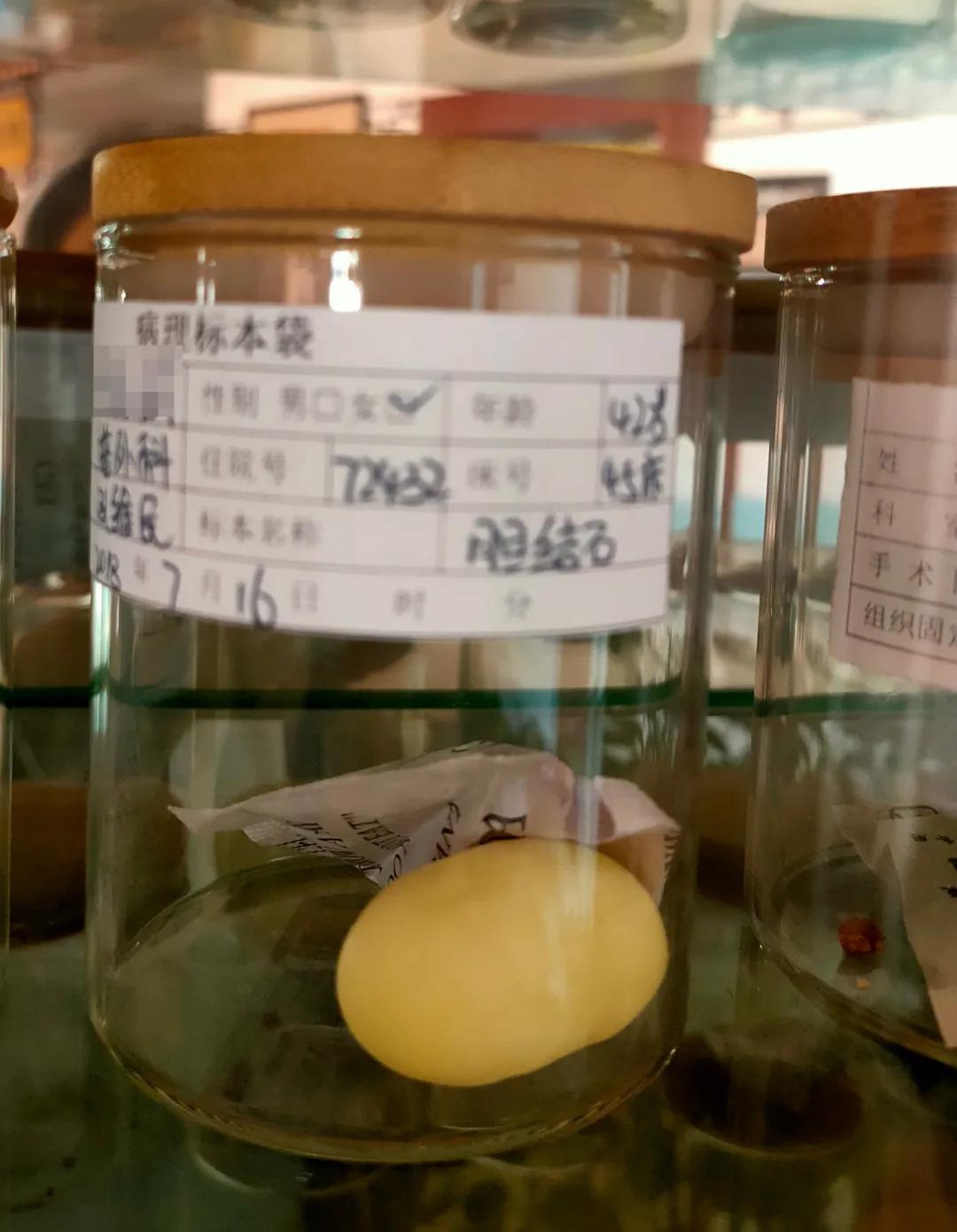 曲靖中医医院微创,曲靖市中医医院微创技术怎么样