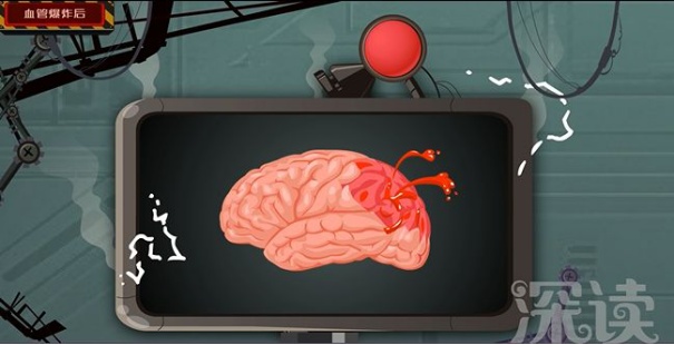 高血压对身体的危害你知道多少,高血压对人体有什么影响和危害