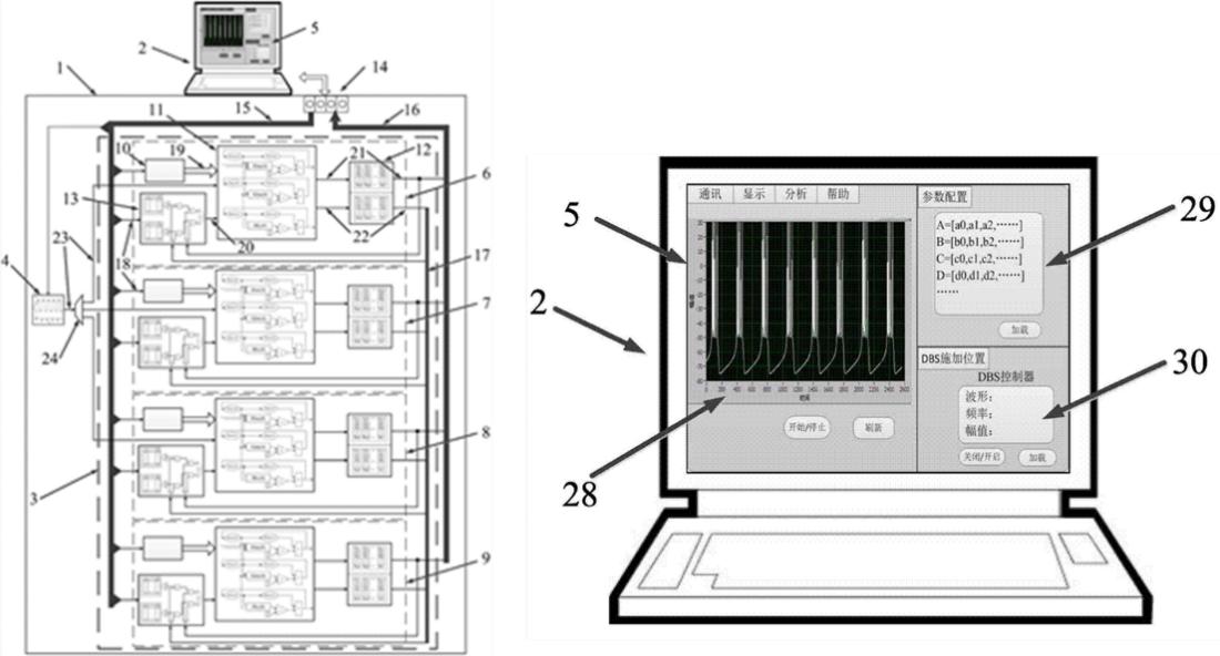 帕金森难题,攻克帕金森的最佳方法