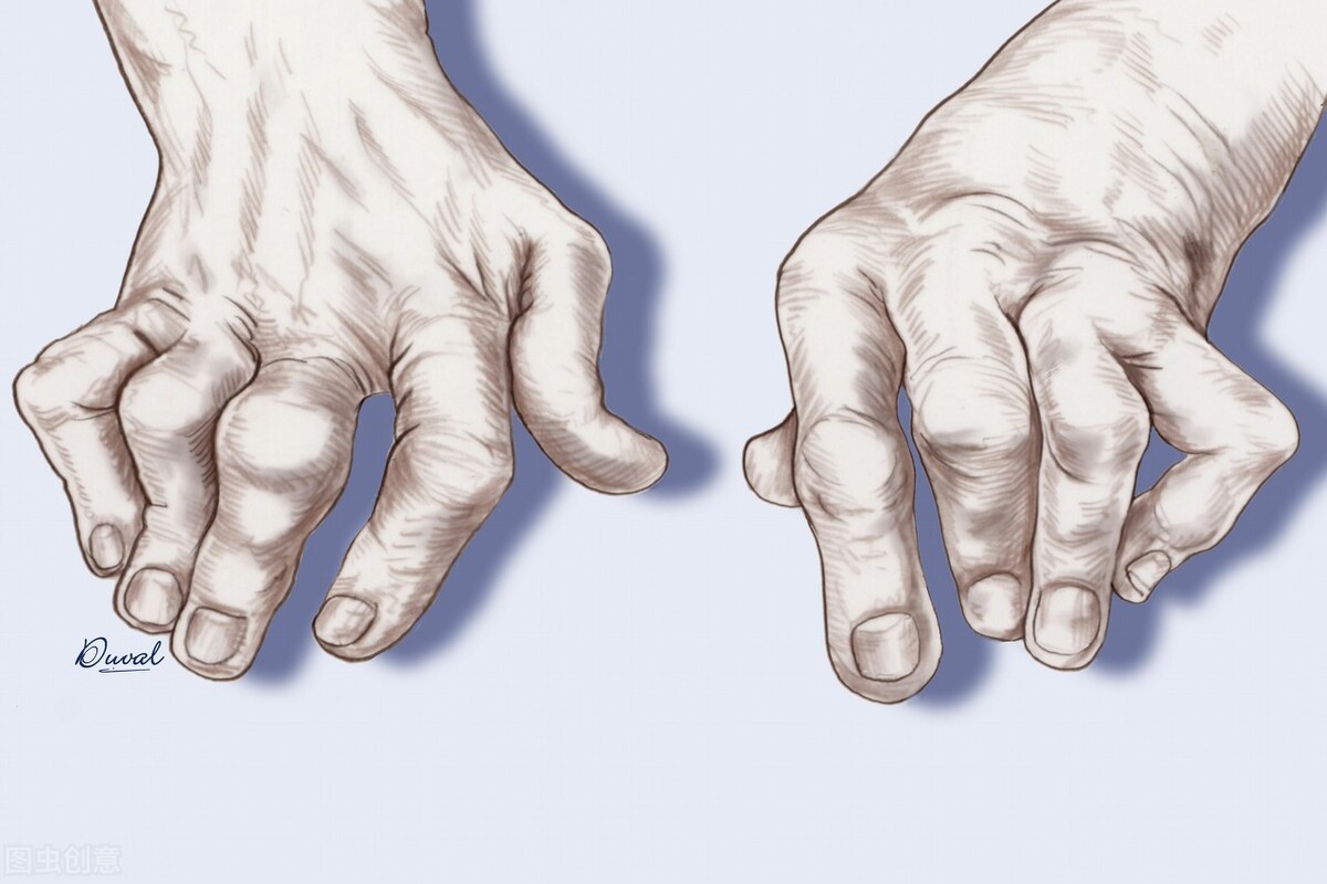 痛风能吃醋吗痛风能吃饺子吗,痛风能吃醋与酸味食物吗