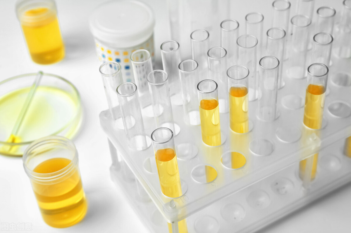 蛋白尿3+通过激素治疗多久能有效,24小时蛋白尿234能治愈吗