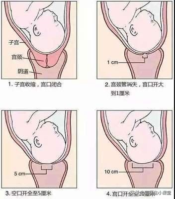顺产是要开十指才能生吗,顺产开十指的感觉