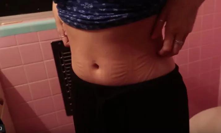 “内脏下垂、子宫脱落、漏尿……”:扒一扒你不知道的网红束腰