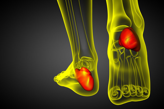 痛风发作天天要吃止痛药,痛风发作吃止痛药副作用