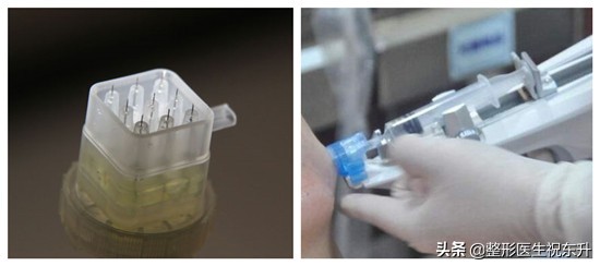 打水光针后的真实感受,水光针注射后1到7天的变化测评