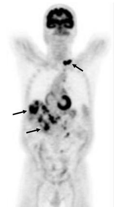 居里夫妇、镭、“派特洗梯”（PET/CT），与医学影像有什么关系？