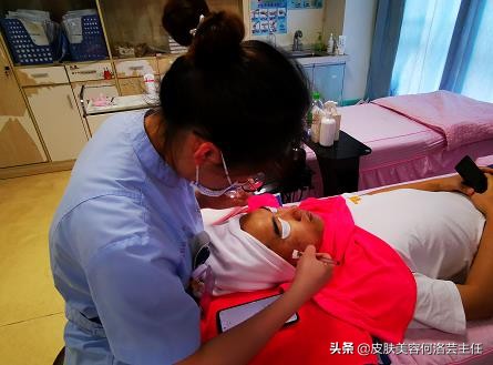 去黑头的有效方法最简单,去黑头的小技巧最管用的办法