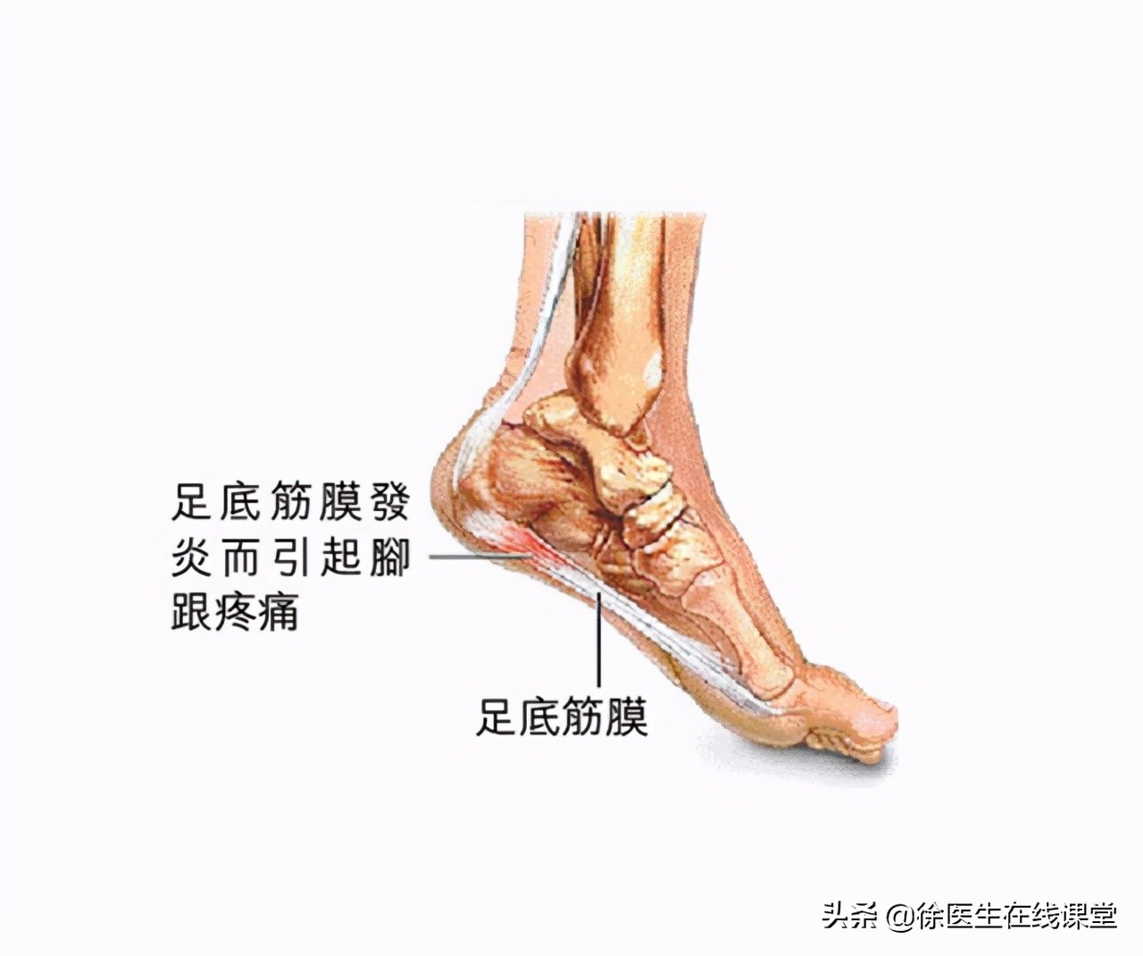 老年人脚底板疼是怎么回事,老年人脚底板痛怎么解决