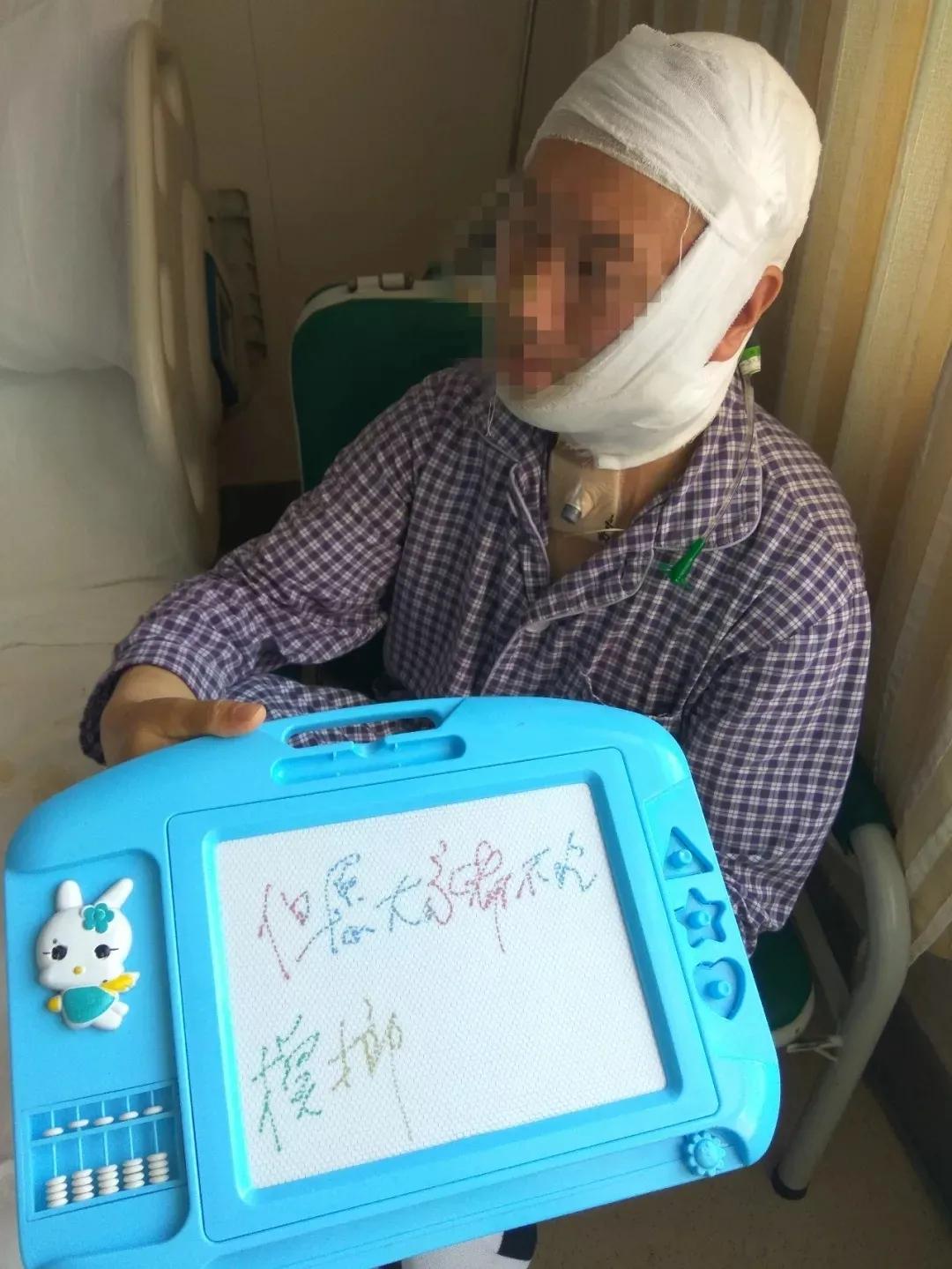 槟榔痴迷者们患上口腔癌的结局 (27岁口腔癌患者自述槟榔上瘾)