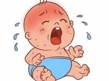 宝宝脸红起湿疹用什么面霜,宝宝冬季脸红湿疹冻疮如何应对