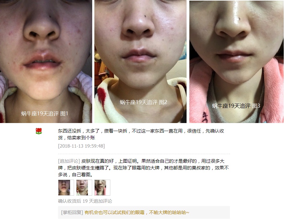 痘痘没了留下红色印记咋办,痘痘没了留下痘印怎么解决