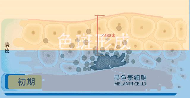祛斑是真的吗,祛斑的是真的有效还是假的有效