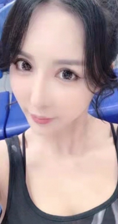 自曝整容经历网红,网红疯狂整容最后脸烂在手术台上