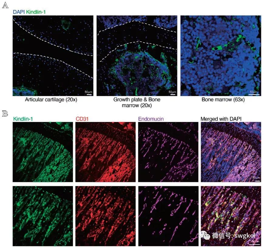 粘着斑相关蛋白Kindlin-1在血管内皮细胞的表达及功能研究
