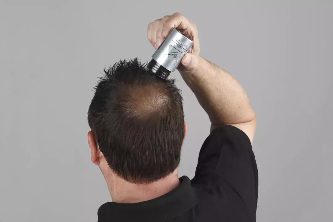 岛国这款生发神器，让你一言不合就长成热带雨林