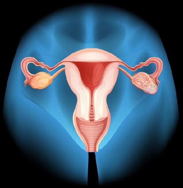 hpv和宫颈癌什么关系,hpv与宫颈癌的关系是一定的吗