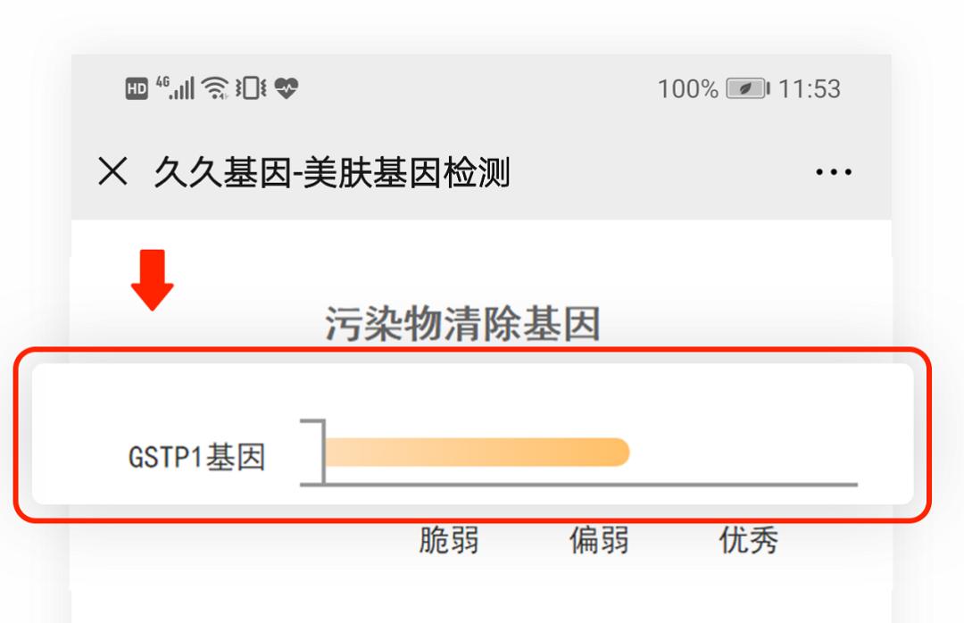 接吻吃口红会不会得病,口红吃到口里有毒吗