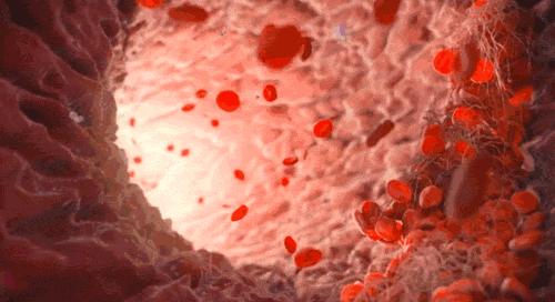 什么原因导致缺铁性贫血吃什么好,缺铁性贫血的病因及治疗方法