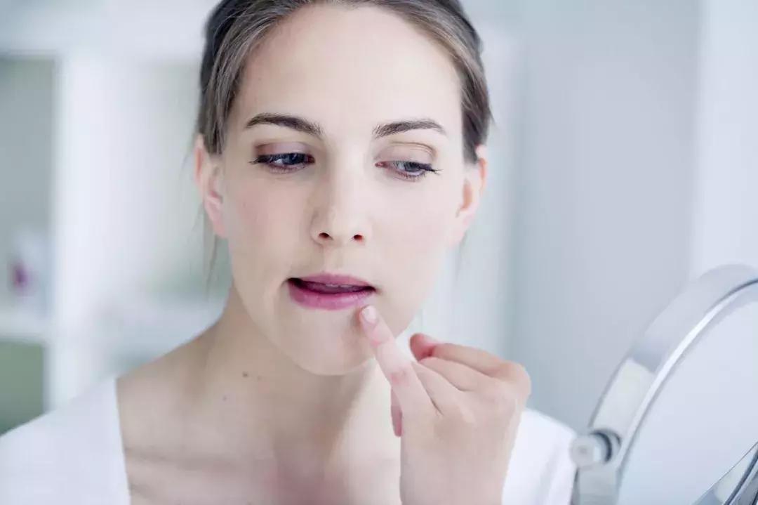 皮肤管理丨假期结束,和你一起上班的可能还有痘痘...