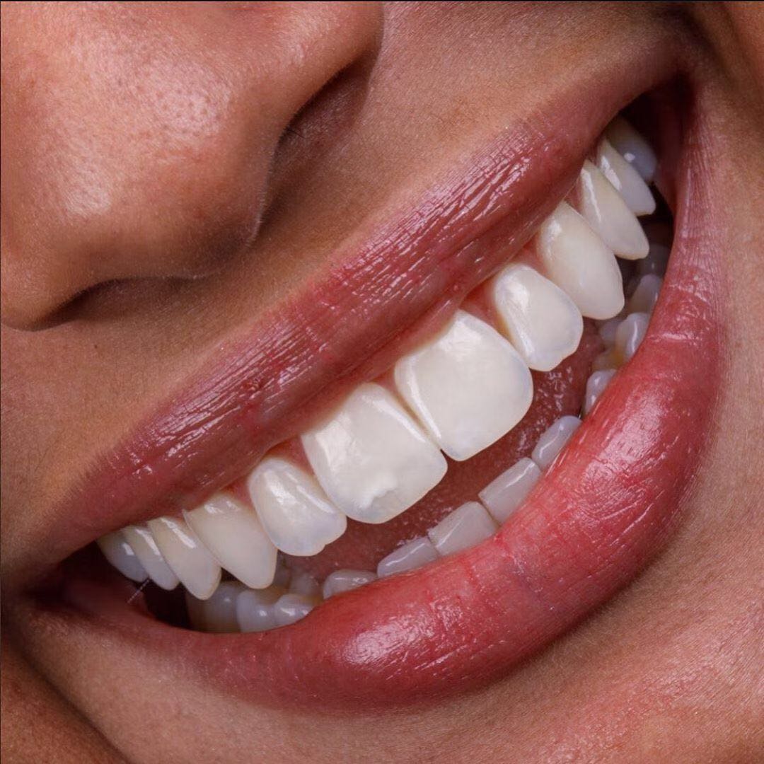 2023年女人最关注的问题,不要整容要整牙