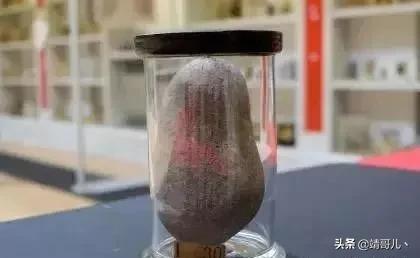 150年来从人体内取出的各式物品