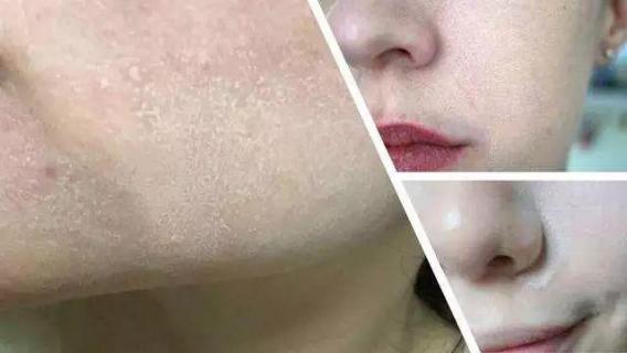 一支bb霜买一送一,一支一支的bb霜