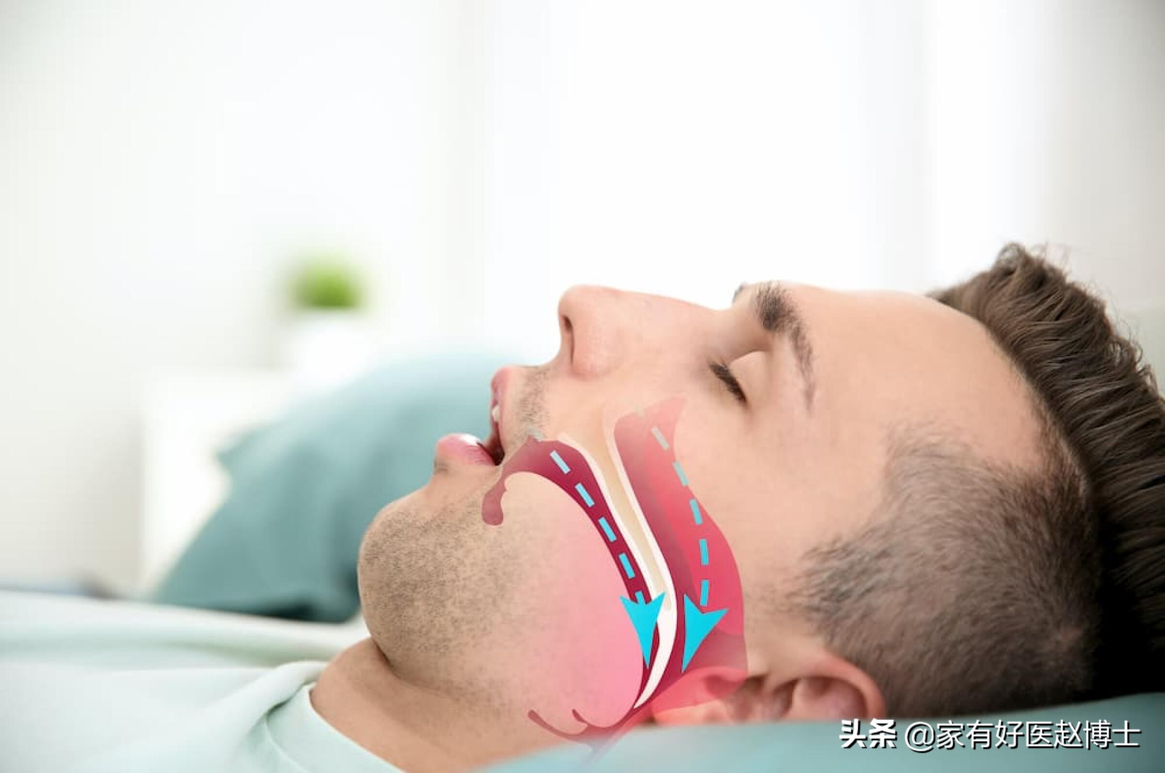 睡眠打鼾的危害科普,打鼾危险性