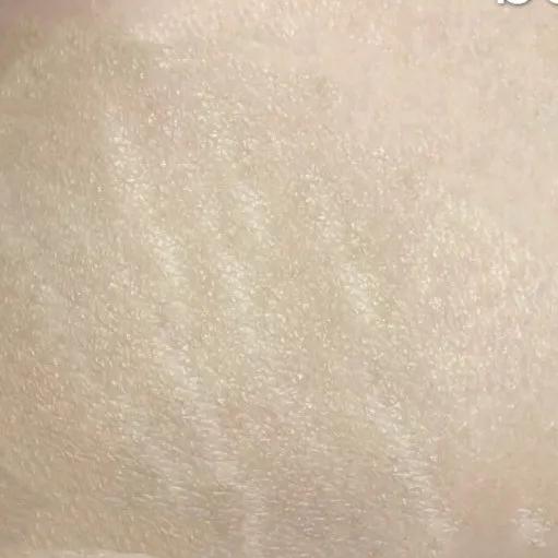 又到了穿小裙的季节，鸡皮女孩该怎么办……