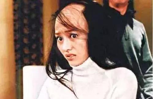 女人脱发,女性其实比男性秃