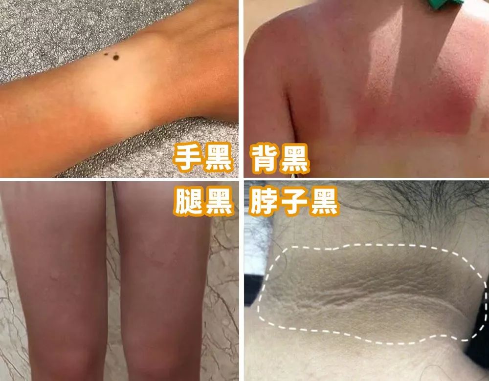 李佳琦推荐澳洲goat羊奶皂,李佳琦推荐黄黑皮克星