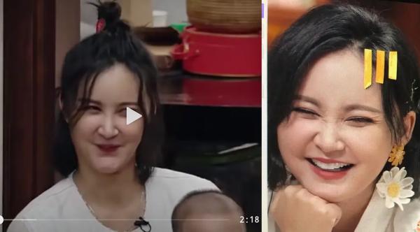 张歆艺用的什么填充脸部,张歆艺填充脸部前后对比