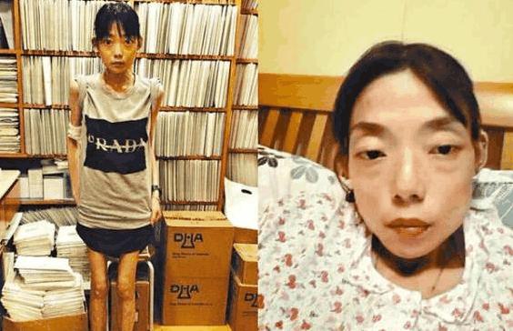 22岁嫁入豪门，结婚8年只剩44斤，嫩模伍智恒究竟经历了什么