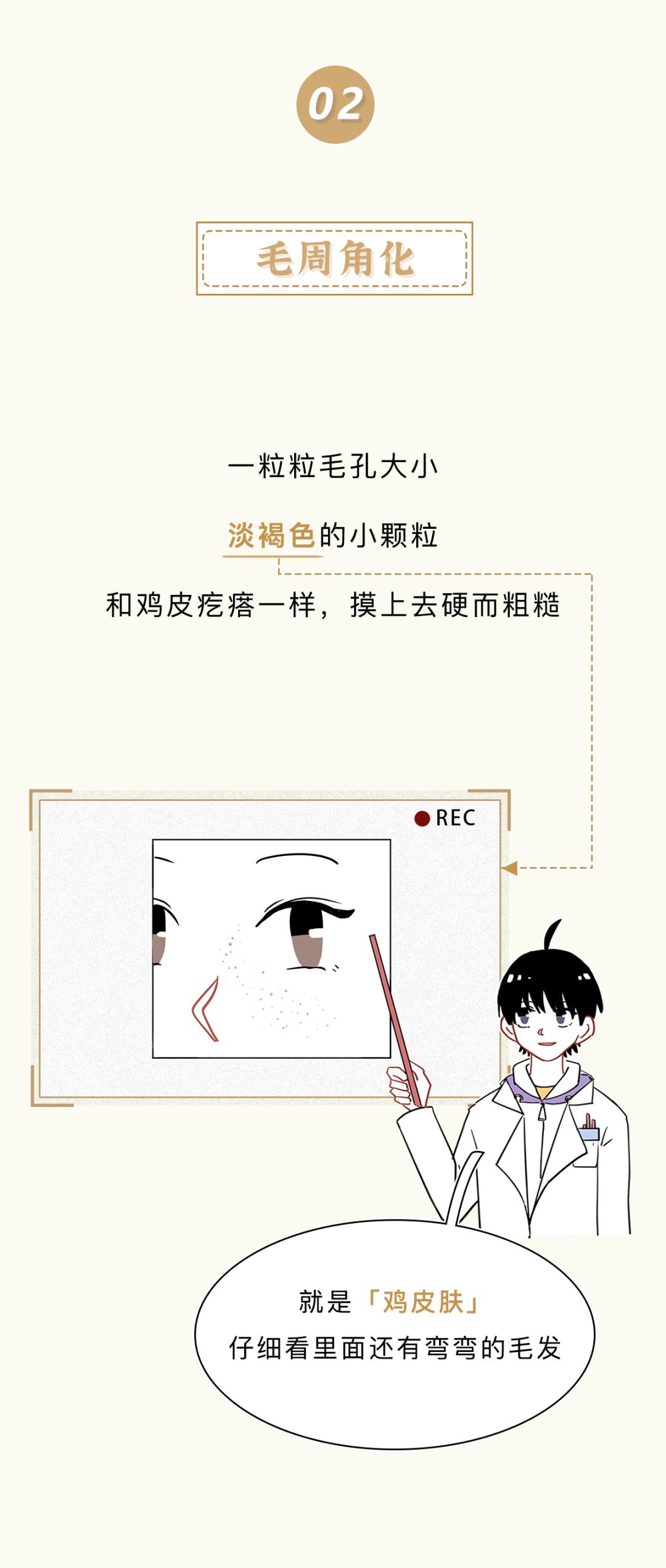 眼睛周围为什么会有脂肪粒,眼睛周围的脂肪粒怎么造成的