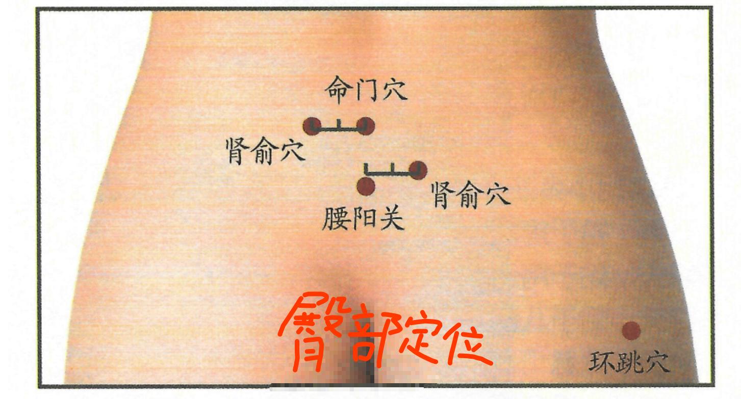 双侧肾俞环跳穴,腰肌劳损艾灸能治愈吗